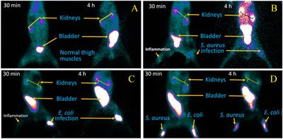 Radiosynthesis, quality control, biodistribution, and infection-imaging study of a new 99mTc-labeled ertapenem radiopharmaceutical